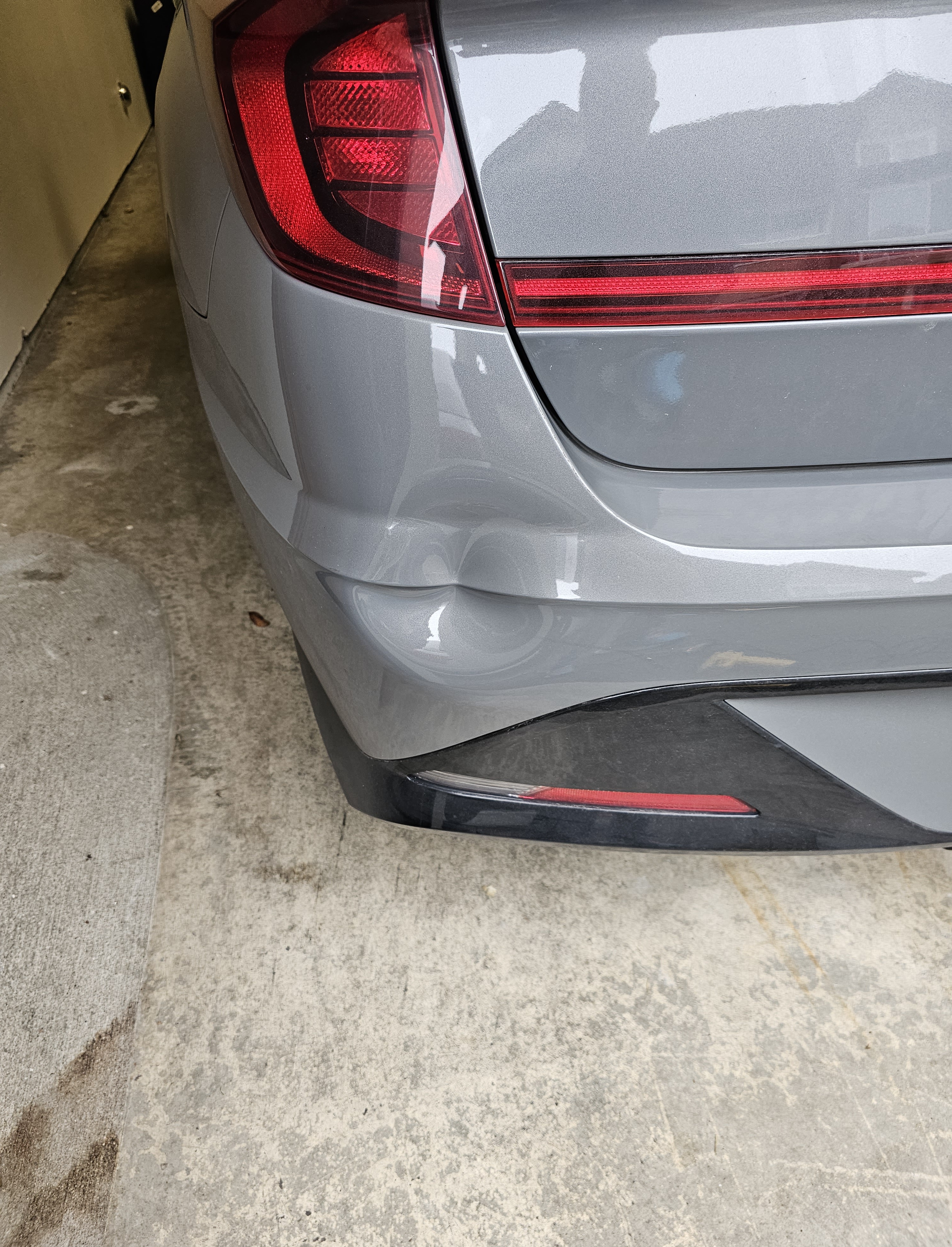 Paintless Dent Removal on a plastic bumper of a 2023 Hyundai Sonata